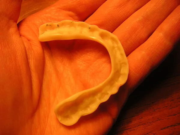 mouth guard